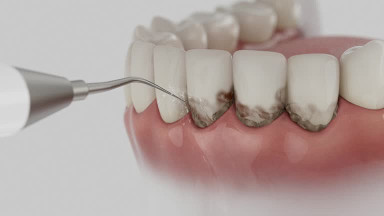 Trusted Teeth Cleaning And Checkup service in China Grove, TX - Dentist Open Now